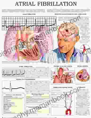 Atrial Fibrillation E Chart: Quick Reference Guide